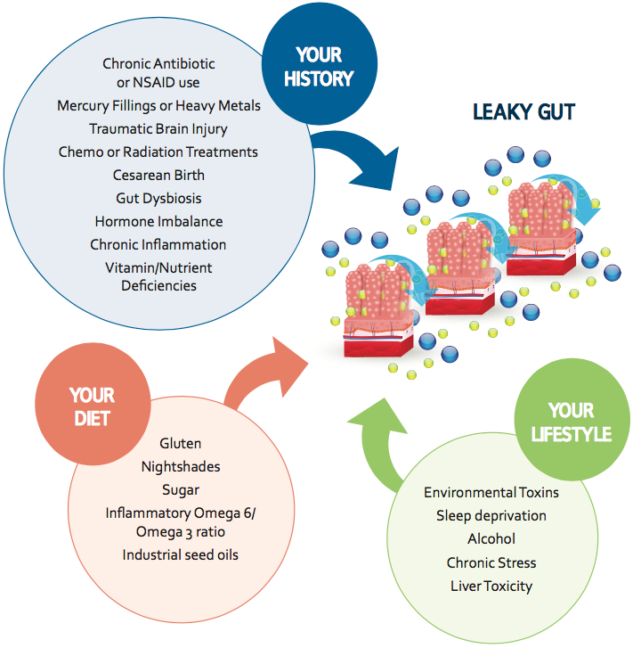 Solving Leaky Gut Triggers Map